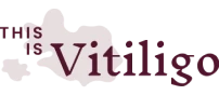 This Is Vitiligo Homepage