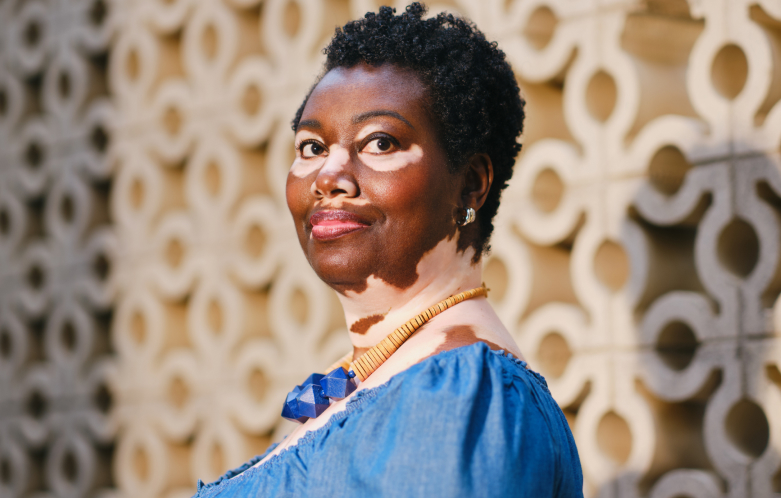 A Black woman with vitiligo smiling in front of a patterned wall