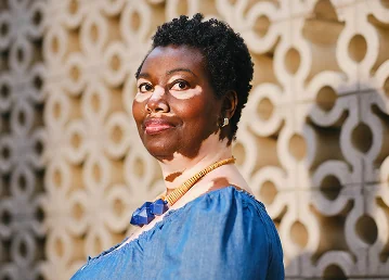 A Black woman with vitiligo smiling in front of a patterned wall